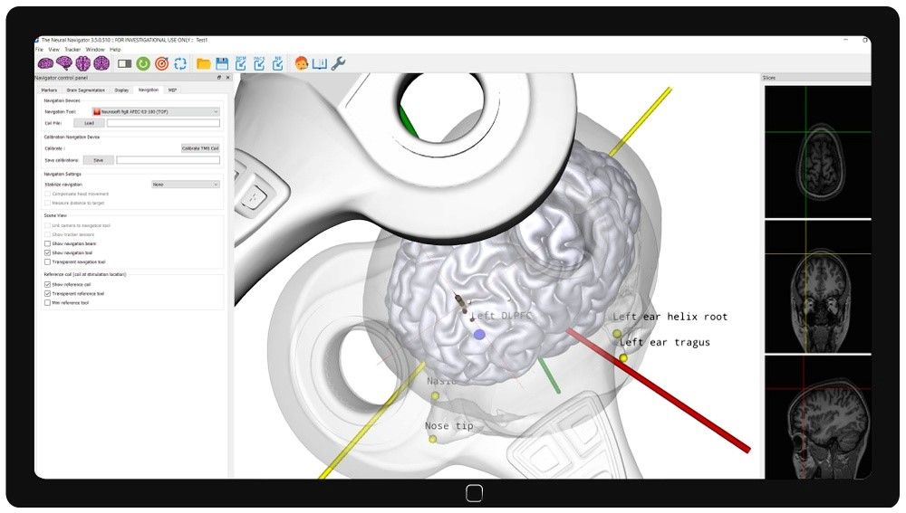 Brain Coil for TMS